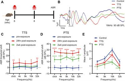 Sirtuin-3 Protects Cochlear Hair Cells Against Noise-Induced Damage via the Superoxide Dismutase 2/Reactive Oxygen Species Signaling Pathway